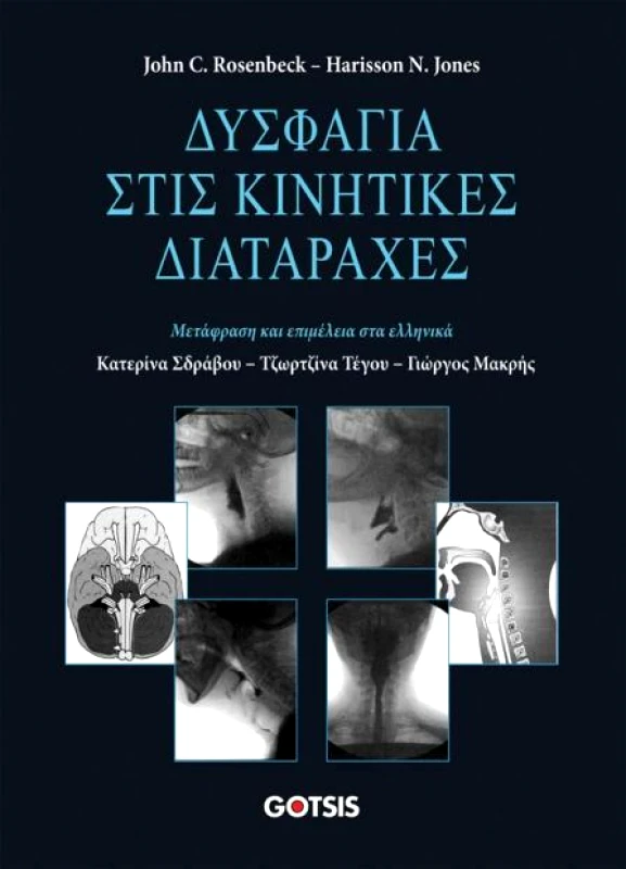 ΓΚΟΤΣΗΣ ΔΥΣΦΑΓΙΑ ΣΤΙΣ ΚΙΝΗΤΙΚΕΣ ΔΙΑΤΑΡΑΧΕΣ