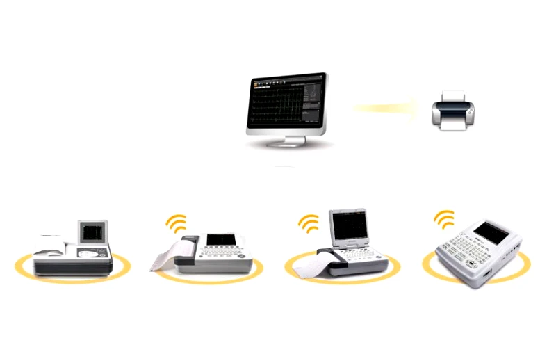 Edan Λογισμικό EDAN Smart ECG-Viewer