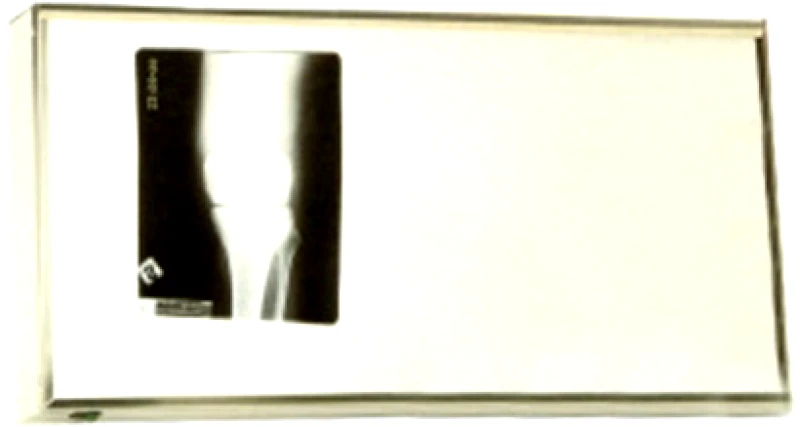 Sigma Medical Διαφανοσκόπιο 2 Θέσεων Επίτοιχο με Inox Πλαίσιο