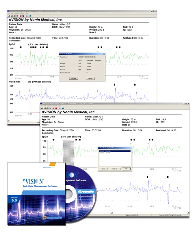 Nonin Λογισμικό Οξυμετρίας Nonin nVISION®