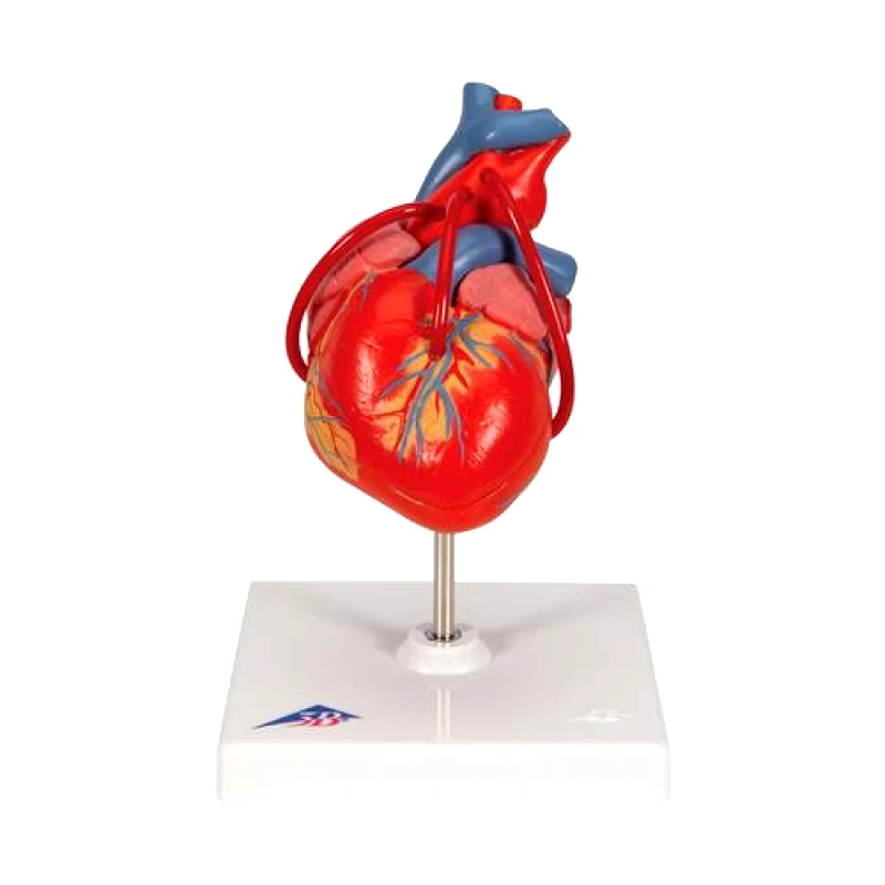 3B Scientific Πρόπλασμα Καρδιάς με Bypass