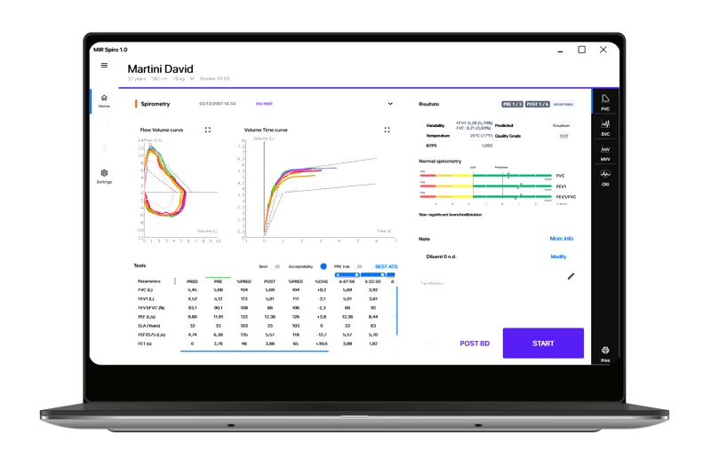 Mir Λογισμικό Σπιρομέτρων Mir Spiro | Συνδρομή Έκδοσης Platinum