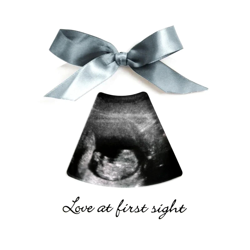 Happy Hands Happy Hands Sonogram Echo Frame διακοσμητικό πλαίσιο