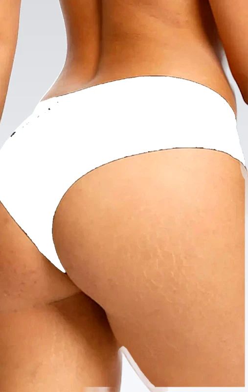 Lingerie Center Laser Cut Κιλοτάκι Ψηλόμεσο - Λευκό - LC2099-Λευκό-XL